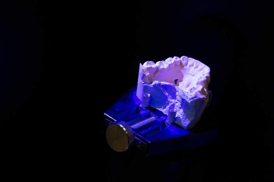 Understanding Digital Impressions for Orthodontic Planning