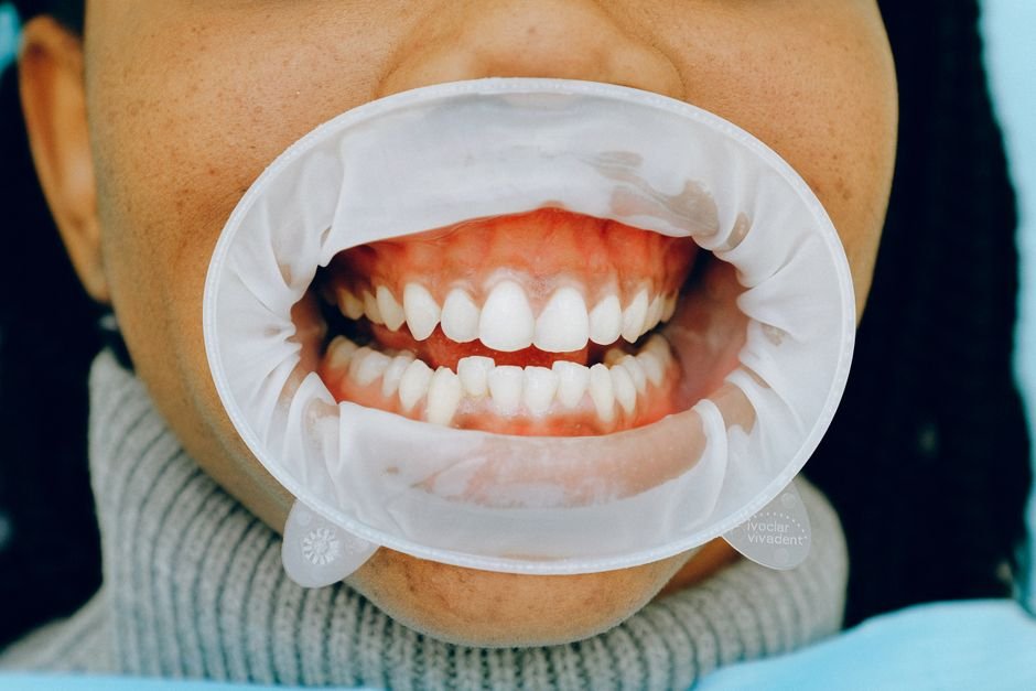 Understanding the Basics of Gum Disease Prevention